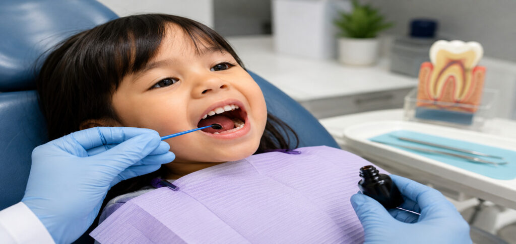 Child receiving drill-free cavity treatment with Silver Diamine Fluoride (SDF) to stop tooth decay